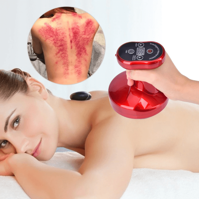 Electric Cupping Therapy Machine
